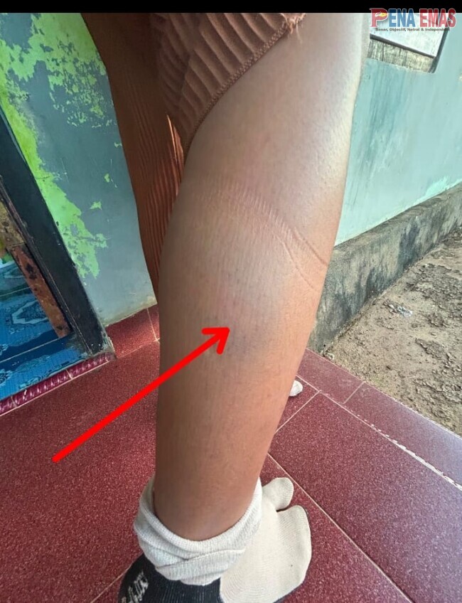 Diduga Penanganan Kasus KDRT Lambat di Polres Rote Ndao, Korban Mengaku Kembali Alami Kekerasan 1 IMG 20260715 WA0008
